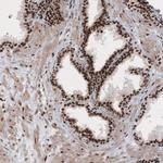 METTL14 Antibody in Immunohistochemistry (IHC)