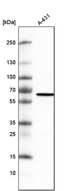 METTL14 Antibody in Western Blot (WB)