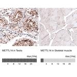 METTL14 Antibody