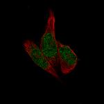 METTL14 Antibody in Immunocytochemistry (ICC/IF)