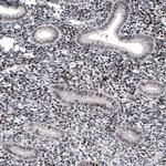 METTL14 Antibody in Immunohistochemistry (IHC)