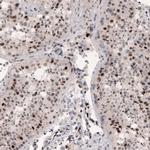 METTL14 Antibody in Immunohistochemistry (IHC)