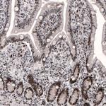 METTL14 Antibody in Immunohistochemistry (IHC)