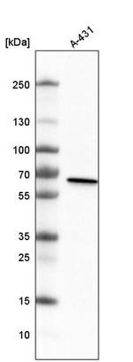 METTL14 Antibody in Western Blot (WB)