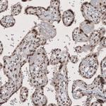 SMCHD1 Antibody in Immunohistochemistry (IHC)