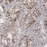 SMCHD1 Antibody in Immunohistochemistry (IHC)