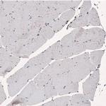 SMCHD1 Antibody in Immunohistochemistry (IHC)