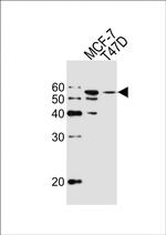 ALDH6A1 Antibody in Western Blot (WB)