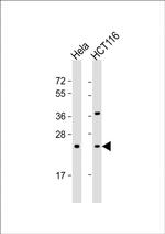 RAB8A Antibody in Western Blot (WB)