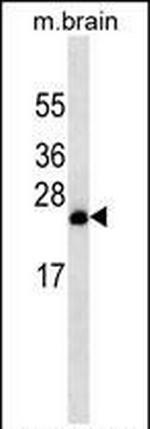 RAB8A Antibody in Western Blot (WB)