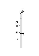 STRA8 Antibody in Western Blot (WB)