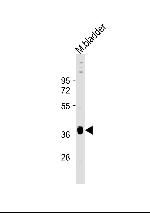 STRA8 Antibody in Western Blot (WB)