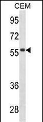 Human IgD Antibody in Western Blot (WB)