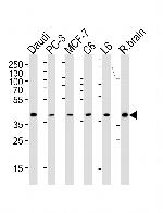 CREB3L4 Antibody in Western Blot (WB)