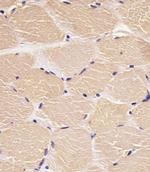 DENR Antibody in Immunohistochemistry (Paraffin) (IHC (P))