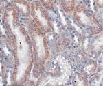 VLDLR Antibody in Immunohistochemistry (IHC)