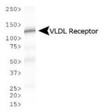 VLDLR Antibody in Western Blot (WB)