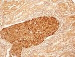 TCCR Antibody in Immunohistochemistry (Paraffin) (IHC (P))