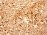 TCCR Antibody in Immunohistochemistry (Paraffin) (IHC (P))