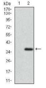 ABCG5 Antibody in Western Blot (WB)