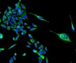 TSPO Antibody in Immunocytochemistry (ICC/IF)