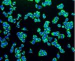 TSPO Antibody in Immunocytochemistry (ICC/IF)