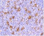 IFNAR1 Antibody in Immunohistochemistry (Paraffin) (IHC (P))