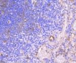 HAPLN1 Antibody in Immunohistochemistry (Paraffin) (IHC (P))