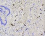 ABCG1 Antibody in Immunohistochemistry (Paraffin) (IHC (P))