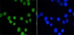 ASH2L Antibody in Immunocytochemistry (ICC/IF)