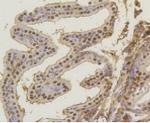 ASH2L Antibody in Immunohistochemistry (Paraffin) (IHC (P))