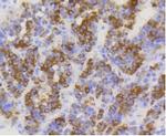 TOMM20 Antibody in Immunohistochemistry (Paraffin) (IHC (P))