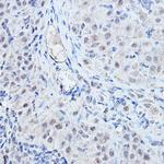 DGCR8 Antibody in Immunohistochemistry (Paraffin) (IHC (P))