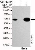 DLAT Antibody in Immunoprecipitation (IP)