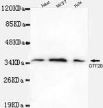 GTF2B Antibody in Western Blot (WB)