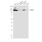 SAFB Antibody in Western Blot (WB)