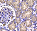 IDH1 Antibody in Immunohistochemistry (Paraffin) (IHC (P))