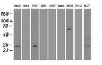 GSC Antibody in Western Blot (WB)