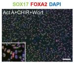 SOX17 Antibody in Immunocytochemistry (ICC/IF)