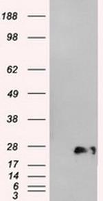 Neurogenin 1 Antibody in Western Blot (WB)