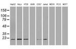 Adenylate Kinase 1 Antibody in Western Blot (WB)