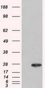 Adenylate Kinase 1 Antibody in Western Blot (WB)