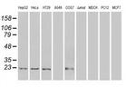 Adenylate Kinase 1 Antibody in Western Blot (WB)