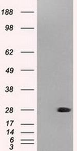 Neurogenin 1 Antibody in Western Blot (WB)