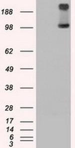 TRPM4 Antibody in Western Blot (WB)