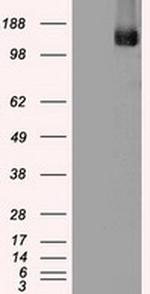 TRPM4 Antibody in Western Blot (WB)