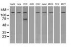 TRPM4 Antibody in Western Blot (WB)