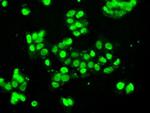 SSB Antibody in Immunocytochemistry (ICC/IF)