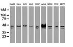 SSB Antibody in Western Blot (WB)