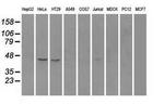 RAD9 Antibody in Western Blot (WB)